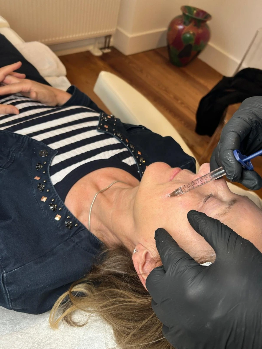 Filler mit Hyaluronsäure, Polynukleotiden und Exosomen in Heidelberg